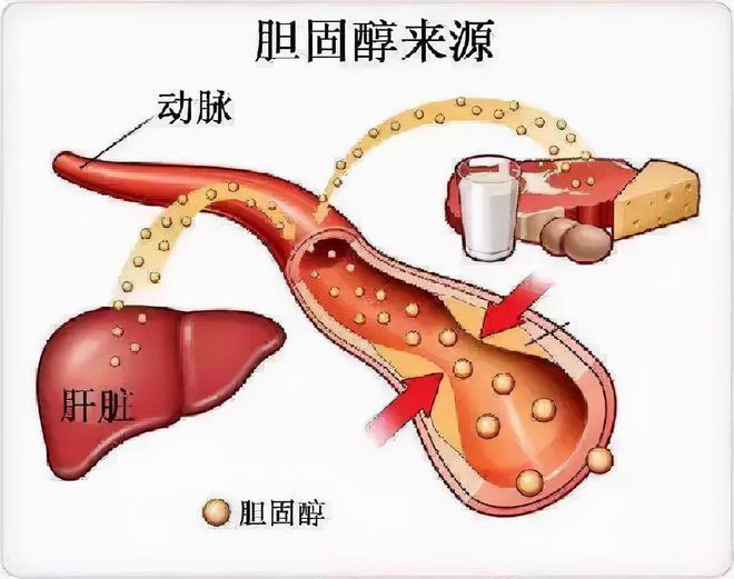 PG电子官方网站胆固醇偏高的人除了饮食之外平时还要注意这3大要素要重视(图4)